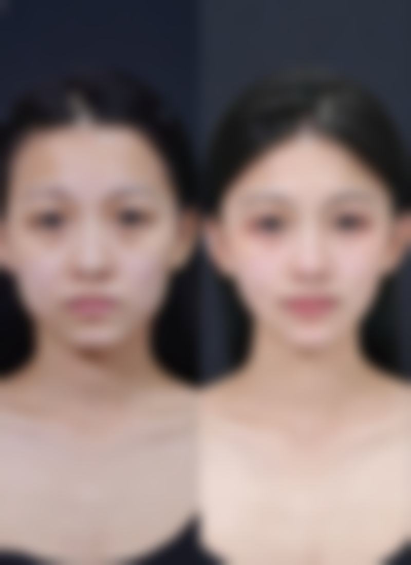 六、浙江宁波章月宝整形医疗美容诊所价格表
