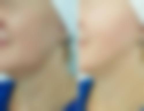 三、北京嫣然天使颅颜中 心美容医院诊疗项目有哪些?