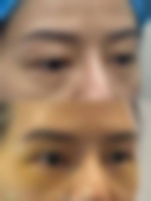 九、湖南湘潭美多多美容诊所真实的患者评价