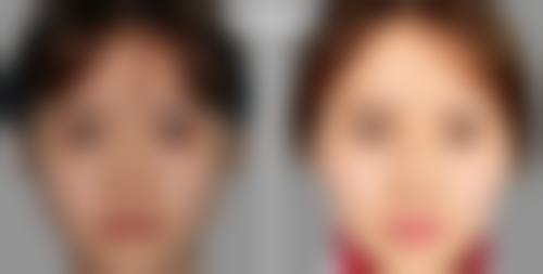六、东莞华美医疗美容价格表