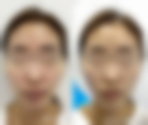 五、南宁伊丽莎白医疗美容门诊部价格表