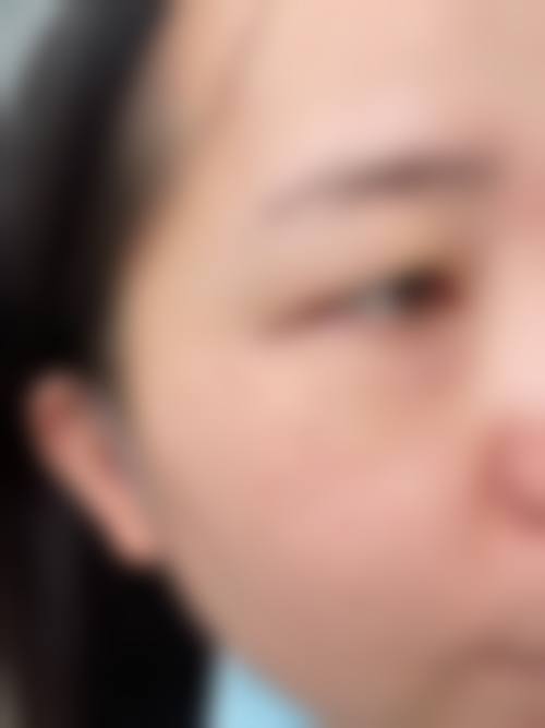 四、呼和浩特华美医疗美容整形诊所特色项目