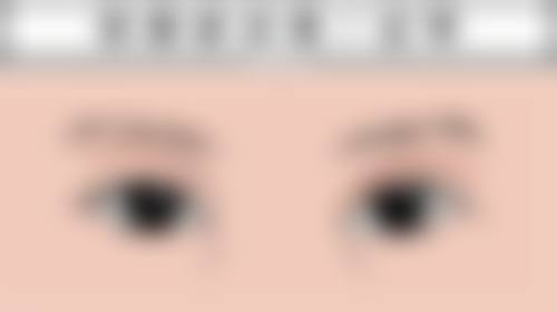 一、眼袋八字纹的成因
