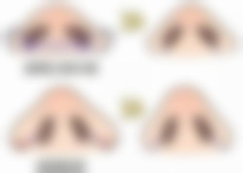 五、耳软骨隆鼻手术后的修复