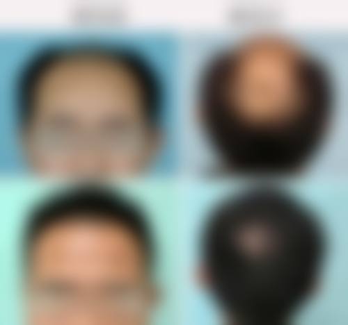四、张国辉收费价格表