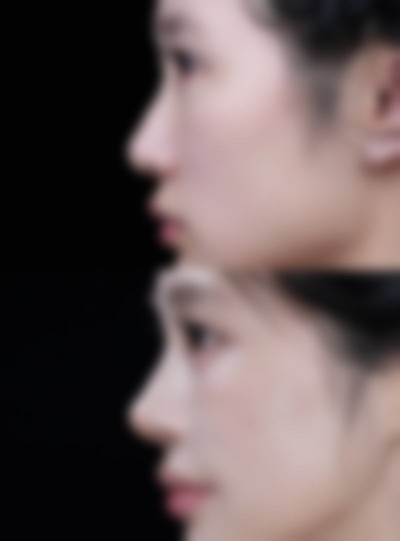四、文山容妍医疗美容门诊部特色项目