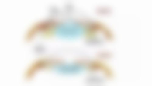 一、割双眼皮抽脂的原理和作用