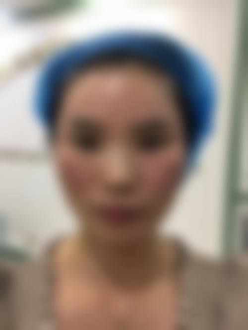 四、东莞雅乔整形医院特色项目