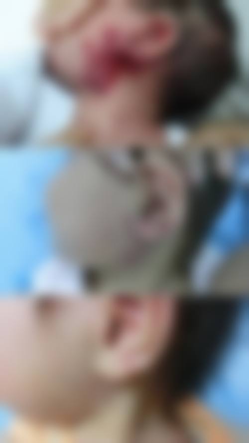 三、中山美熙整形医院诊疗项目有哪些？
