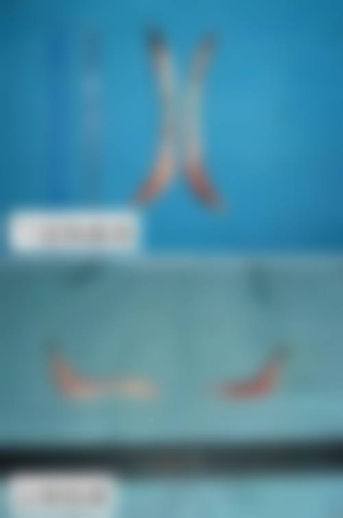 二、中山美熙整形医院怎么样？