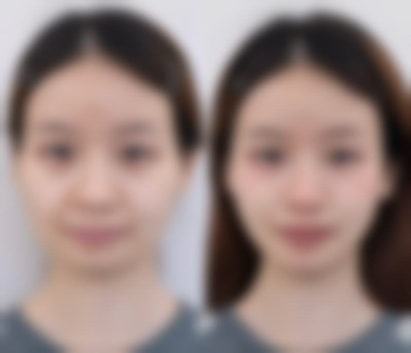 二、类蛇毒肽是什么？有啥作用