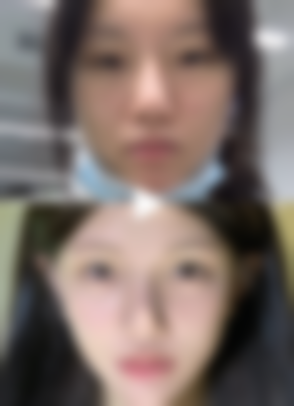 九、深圳臻艺医疗美容真实的患者评价