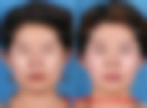 二、郴州欧阳小莲整形医院怎么样？
