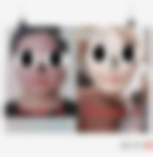 八、广州健康医然医疗美容门诊部真实的患者评价