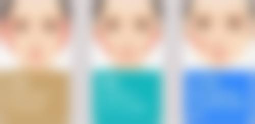 四、毛发种植术可靠吗？术后成效及修复