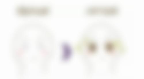 五、“自己脂肪丰太阳穴恒久吗”之总结与提醒