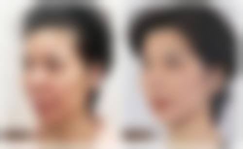 八、成都锦江新诺亚齿科真实的患者评价