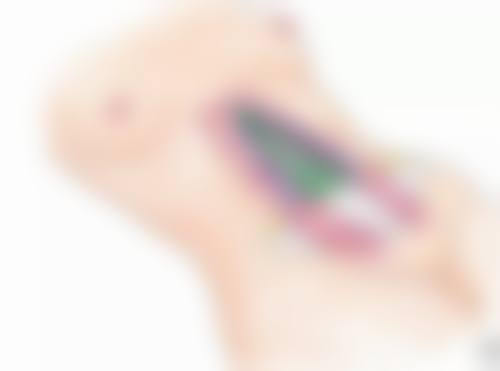 五、武汉斯启诺医疗热玛吉的性价比