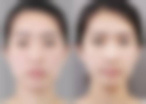 六、金炯锡真实的患者评价