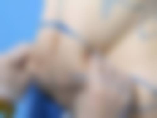二、什么年龄做祛眼袋手术更好——其他年龄段的情况