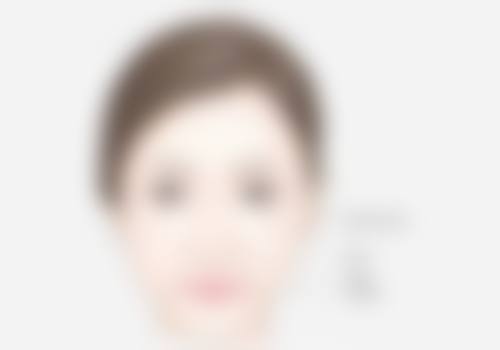 二、割的双眼皮还能还原吗之不能完全还原的原因