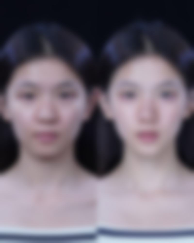 三、为什么做了手术疤痕发痒之应对方法