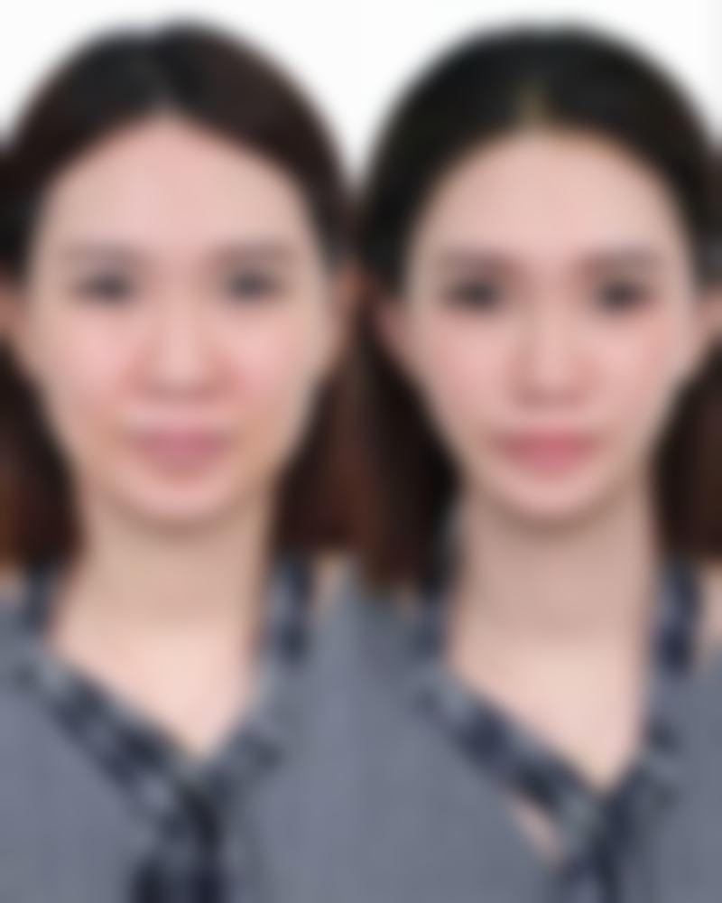 七、保定宸星整形医院预约方式