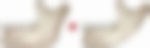 四、眼贴使用的注意事项