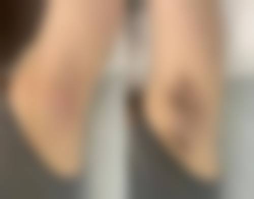 八、南京薇依整形医院真实的患者评价