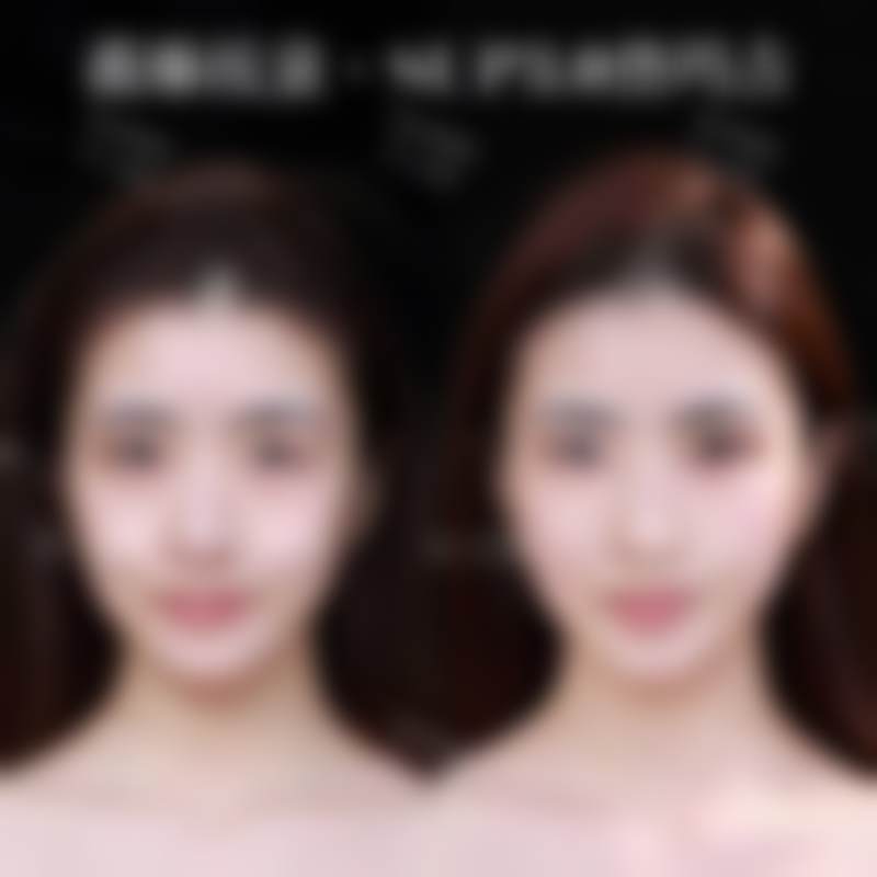 九、杭州薇琳医疗美容医院真实的患者评价