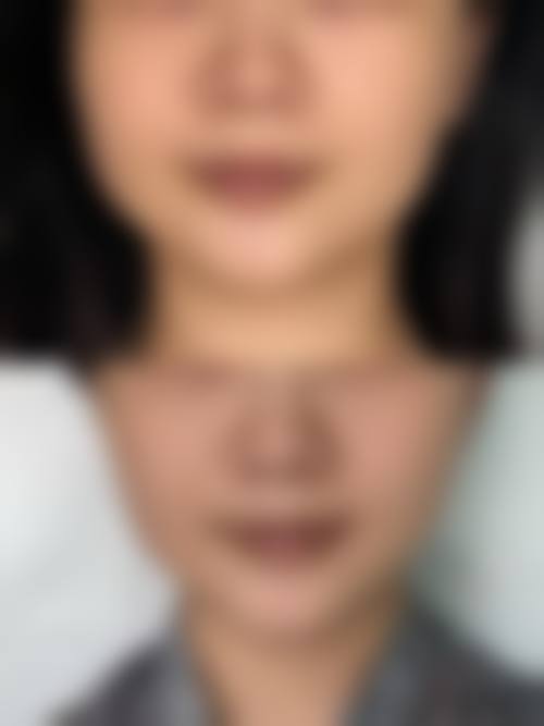 六、光子国内外医学美肤价格表