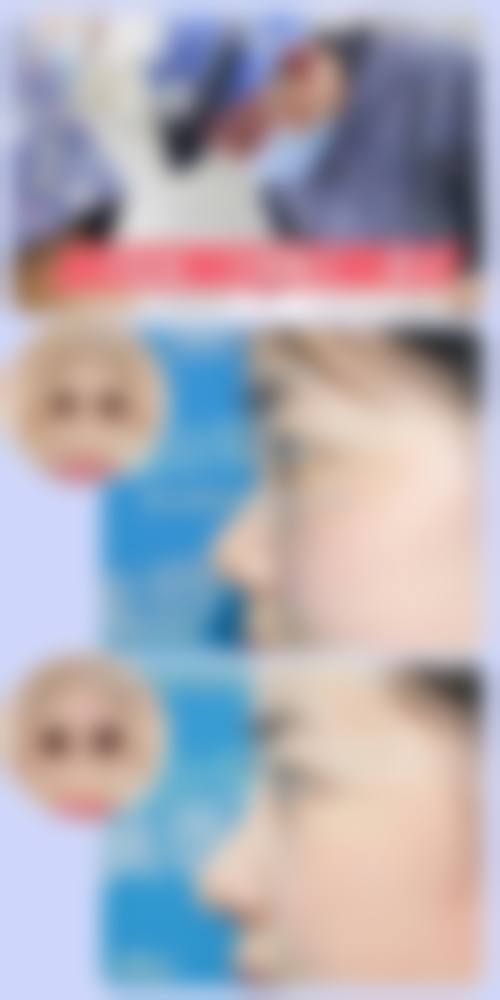 四、合肥怡君医疗整形美容诊所特色项目