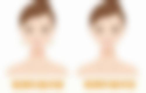 一、疤痕增生后会疼吗?疼痛原因大揭秘