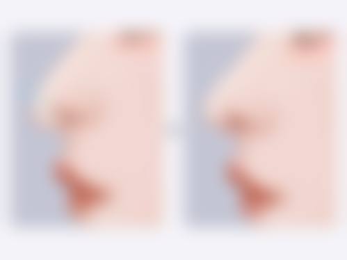 八、竹原SkinClinic真实的患者评价