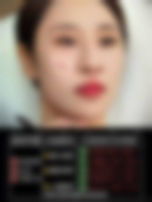 四、常州谐美德尔美客医疗美容门诊部特色项目