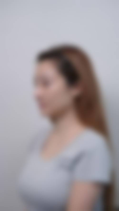 六、邯郸佑熙医疗美容门诊部价格表