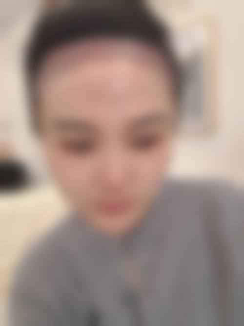 四、成都少城医院医疗美容科特色项目