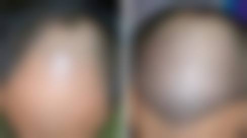 五、黄冈黄州韩美医疗美容诊所价格表