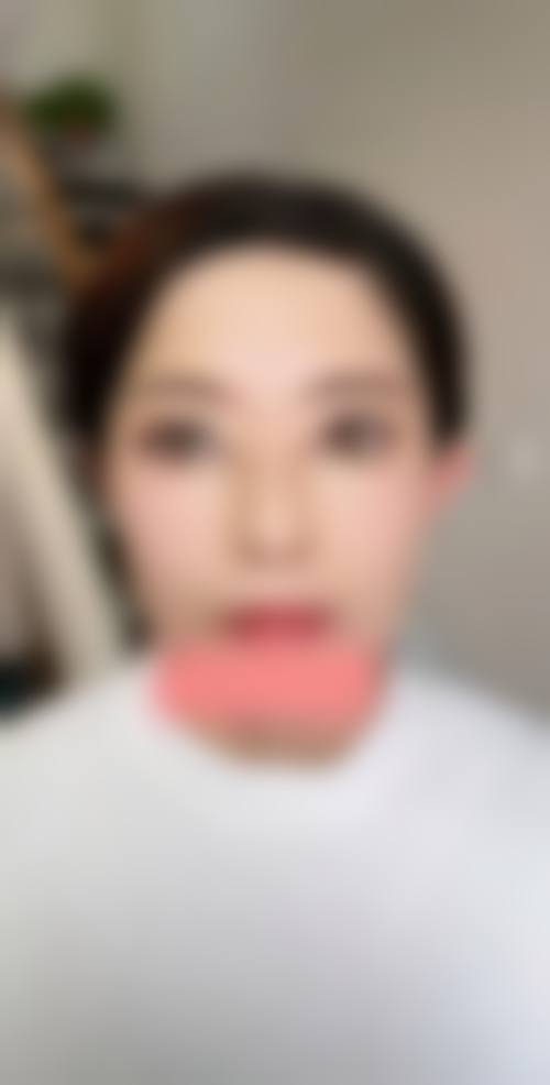 四、厦门伊美整形医院特色项目