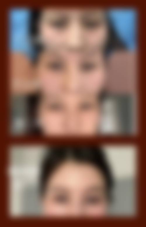 三、曹县智美好医美容整形诊疗项目有哪些?