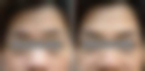 四、杨润乭口腔颌面部外科特色项目