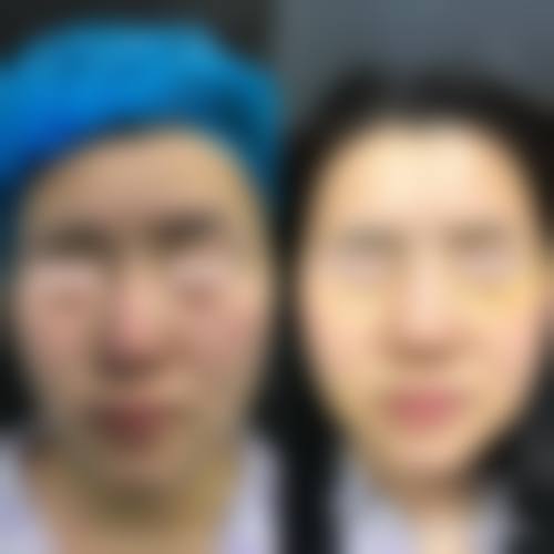 二、信阳市中 心医院烧伤整形外科怎么样?