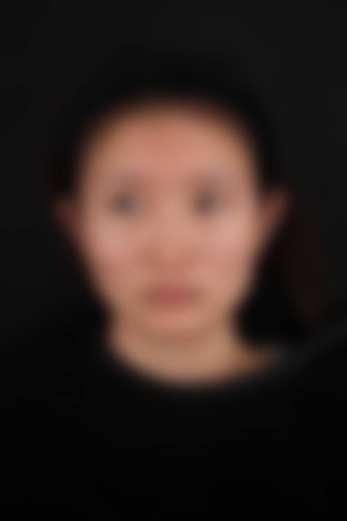 二、Kalon美容诊所怎么样?
