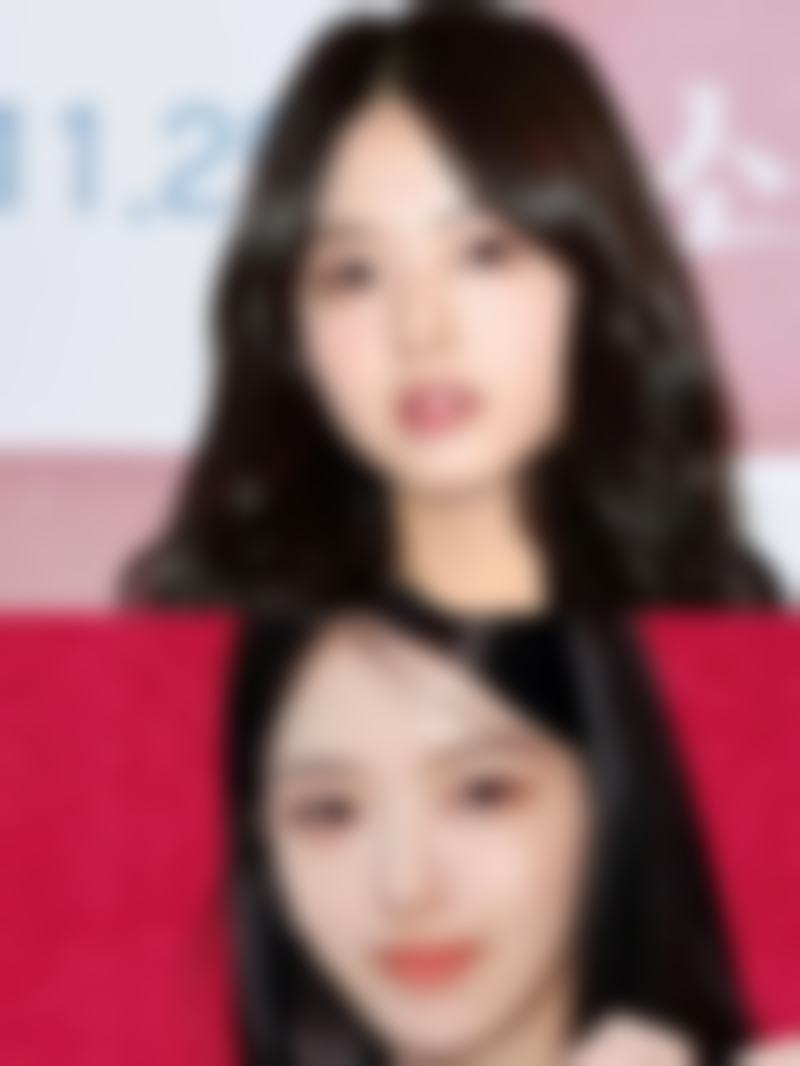 四、医美治疗改善黑眼圈眼袋