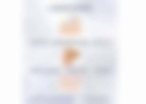 二、假体隆胸成效之增大乳房体积