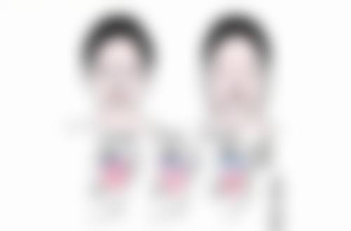 五、割双眼皮后吃糯米与增生的关系
