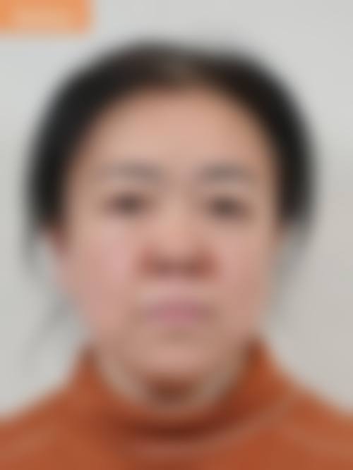 九、南充刘明刚医疗美容诊所真实的患者评价