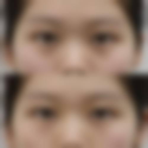 八、长沙天一整形美容医院真实的患者评价