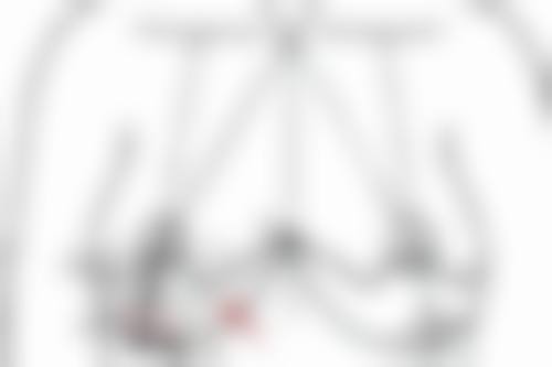 九、韩国爱起来整形医院真实的患者评价