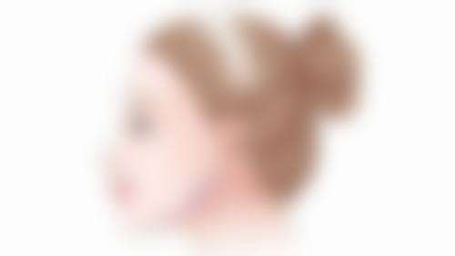 四、避免剧烈运动,减少双眼皮切口裂开风险